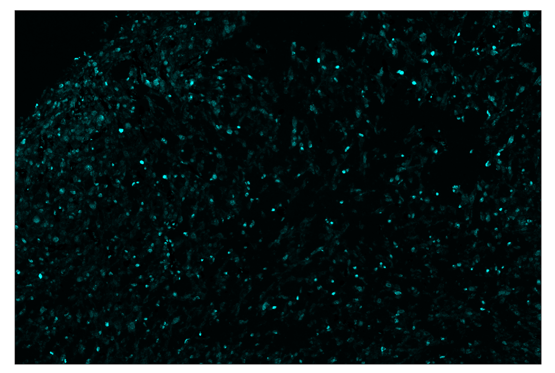 Immunohistochemistry Image 5: Ki-67 (D3B5) & CO-0052-750 SignalStar<sup>™</sup> Oligo-Antibody Pair