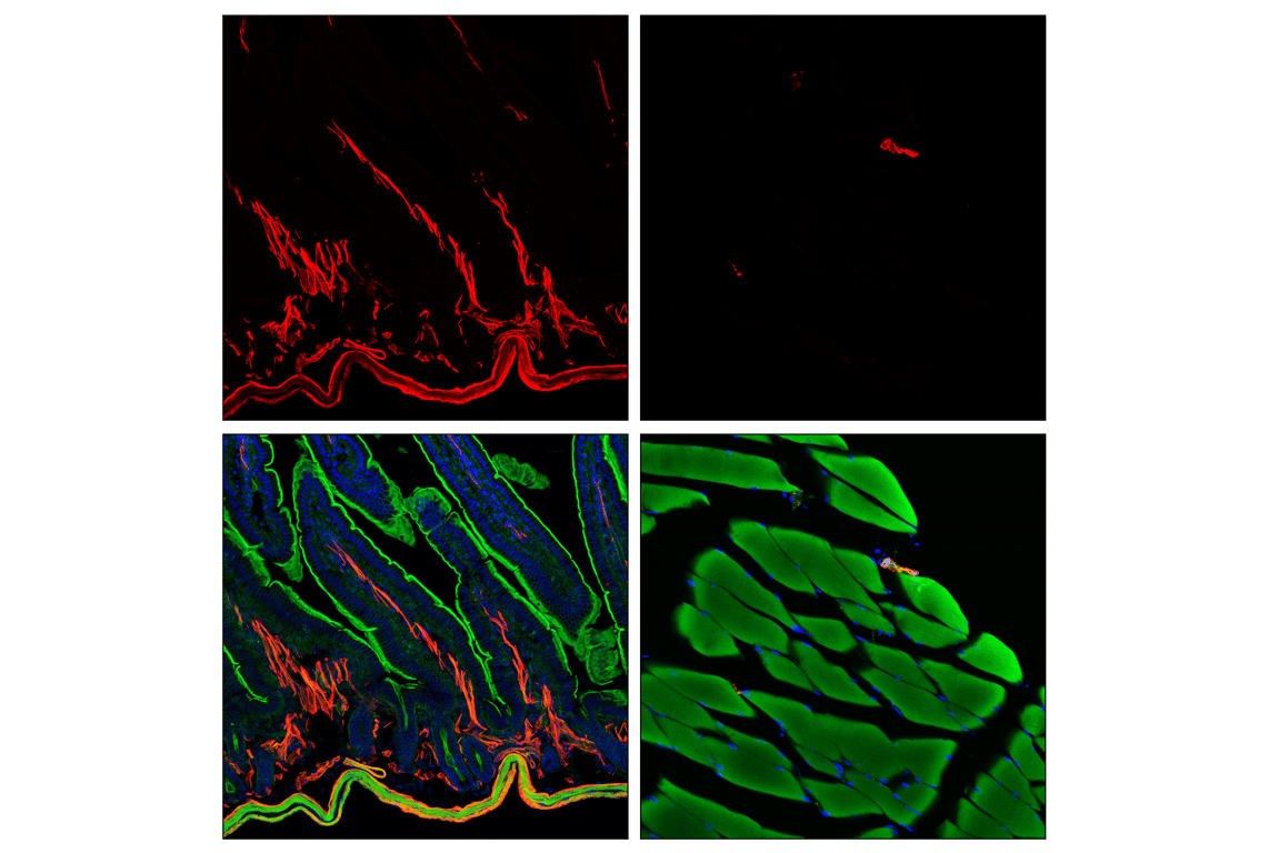 Immunofluorescence Image 1: α-Smooth Muscle Actin (D4K9N) XP<sup>®</sup> Rabbit mAb (Alexa Fluor<sup>®</sup> 555 Conjugate)