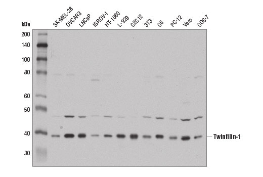 Western Blotting Image 1: Twinfilin-1 (D7C6J) Rabbit mAb