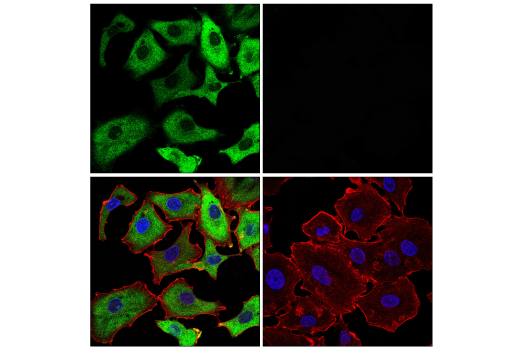 Immunofluorescence Image 1: SARS-CoV-2 Nucleocapsid Protein (E9L7H) XP<sup>®</sup> Rabbit mAb