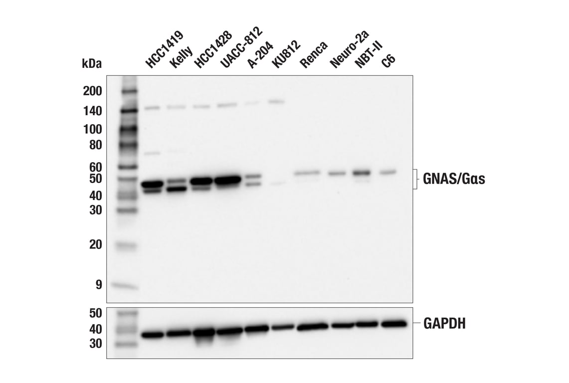 Western Blotting Image 1: GNAS/Gαs (E4G1G) Rabbit mAb