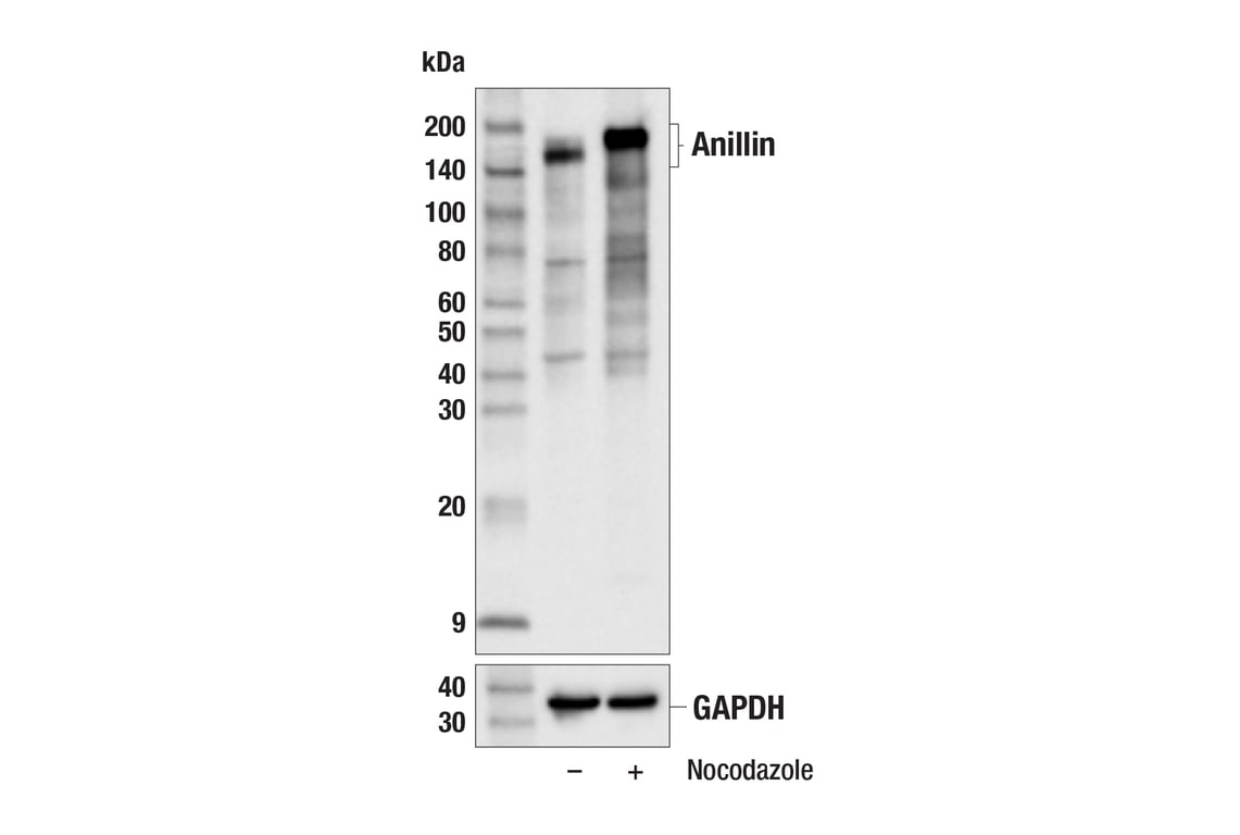 Western Blotting Image 2: Anillin (E9L6E) Rabbit mAb