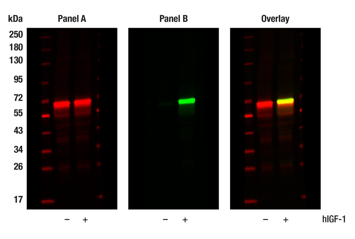 undefined Image 51: TREM2-dependent mTOR Metabolic Fitness Antibody Sampler Kit