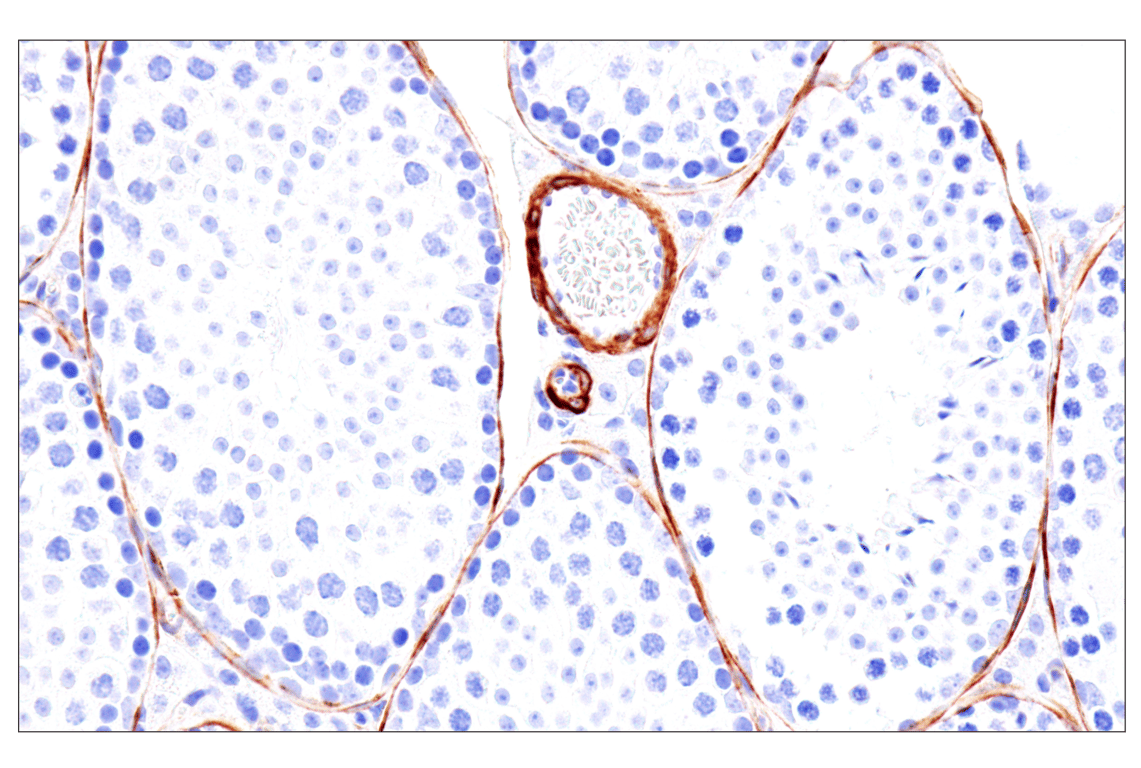 MYH11 (E4N8M) Rabbit mAb (BSA and Azide Free) | Cell
