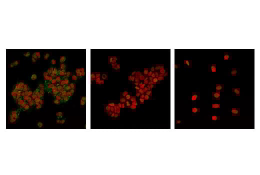 Immunofluorescence Image 1: Non-phospho (Active) β-Catenin (Ser33/37/Thr41) (D13A1) Rabbit mAb
