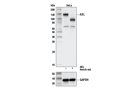 Western Blotting Image 1: Axl (C44G1) Rabbit mAb