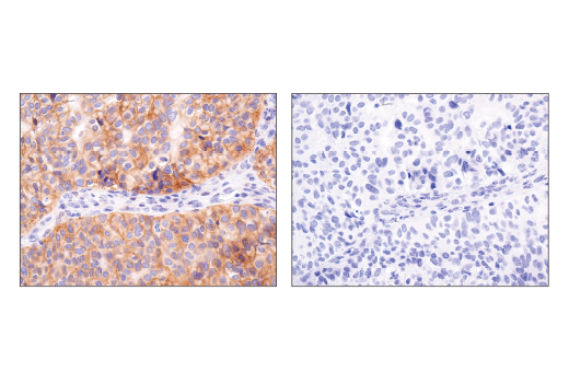 Immunohistochemistry Image 7: Notch2 (D76A6) XP<sup>®</sup> Rabbit mAb (BSA and Azide Free)