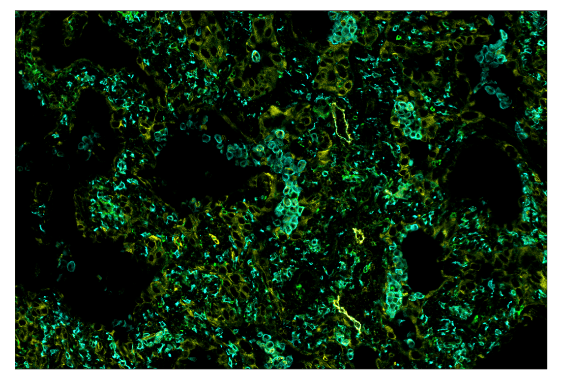 Immunohistochemistry Image 7: NT5E/CD73 (D7F9A) & CO-0039-750 SignalStar<sup>™</sup> Oligo-Antibody Pair