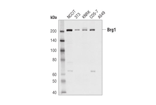 undefined Image 12: BAF Complex Antibody Sampler Kit II