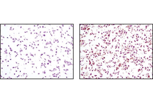 Immunohistochemistry Image 4: PTEN (D4.3) XP<sup>®</sup> Rabbit mAb (BSA and Azide Free)