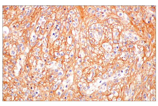 Immunohistochemistry Image 9: COL3A1 (E8D7R) XP<sup>®</sup> Rabbit mAb (BSA and Azide Free)