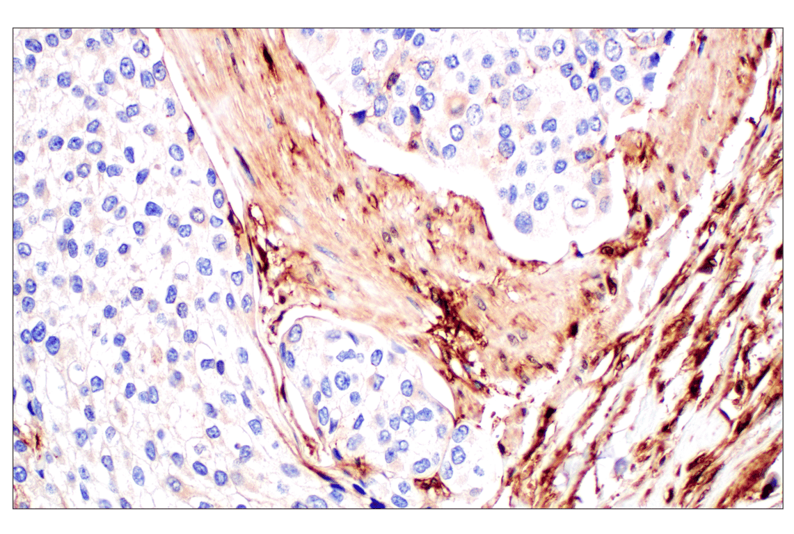 Immunohistochemistry Image 4: Annexin V (E3W8V) Rabbit mAb (BSA and Azide Free)