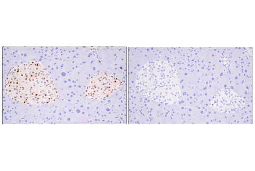 Immunohistochemistry Image 6: Cyclin D1 (E3P5S) XP<sup>®</sup> Rabbit mAb (BSA and Azide Free)