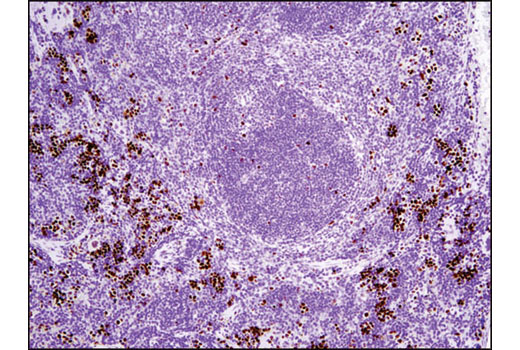 Immunohistochemistry Image 4: Phospho-Rb (Ser807/811) (D20B12) XP<sup>®</sup> Rabbit mAb (BSA and Azide Free)