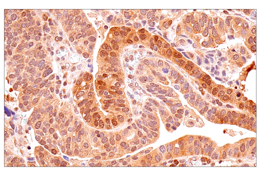 Immunohistochemistry Image 1: p70 S6 Kinase (E8K6T) XP<sup>®</sup> Rabbit mAb