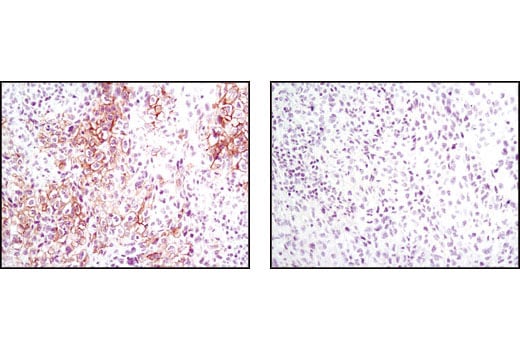 Immunohistochemistry Image 1: Phospho-Met (Tyr1234/1235) (D26) XP<sup>®</sup> Rabbit mAb (BSA and Azide Free)
