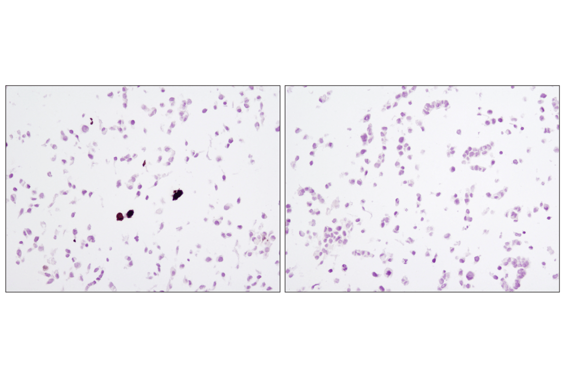 Immunohistochemistry Image 1: HA-Tag (C29F4) Rabbit mAb
