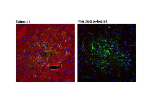 undefined Image 31: LRP1-mediated Endocytosis and Transmission of Tau Antibody Sampler Kit