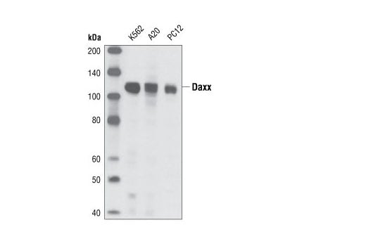undefined Image 5: ATRX/Daxx Antibody Sampler Kit