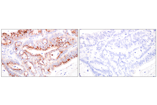 Immunohistochemistry Image 3: CD70 (E3Q1A) Rabbit mAb (BSA and Azide Free)