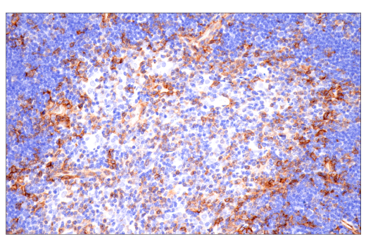 Immunohistochemistry Image 6: CD38 (E9F5A) XP<sup>®</sup> Rabbit mAb
