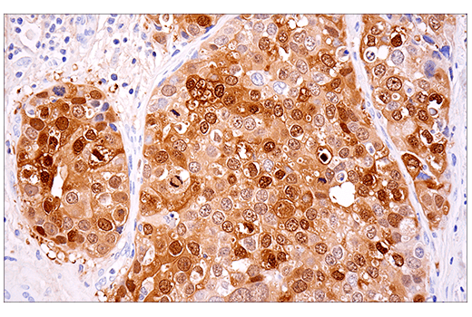 Immunohistochemistry Image 8: Calretinin (E7R6O) XP<sup>®</sup> Rabbit mAb