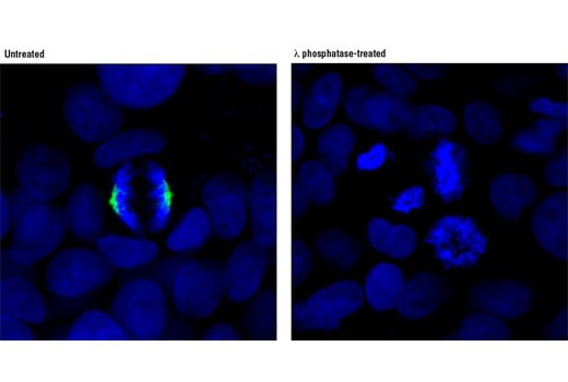 Immunofluorescence Image 1: Phospho-TACC3 (Ser558) (D8H10) XP<sup>®</sup> Rabbit mAb