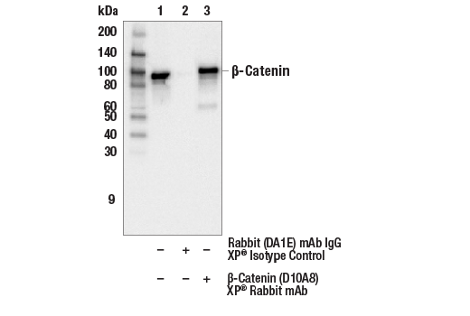 undefined Image 55: Cadherin-Catenin Antibody Sampler Kit