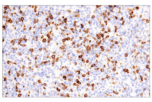 Immunohistochemistry Image 2: CD7 (LP15) Mouse mAb