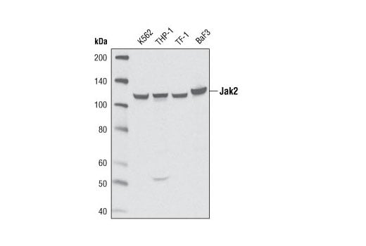 undefined Image 14: Stat3/Stat5 Signaling Antibody Sampler Kit