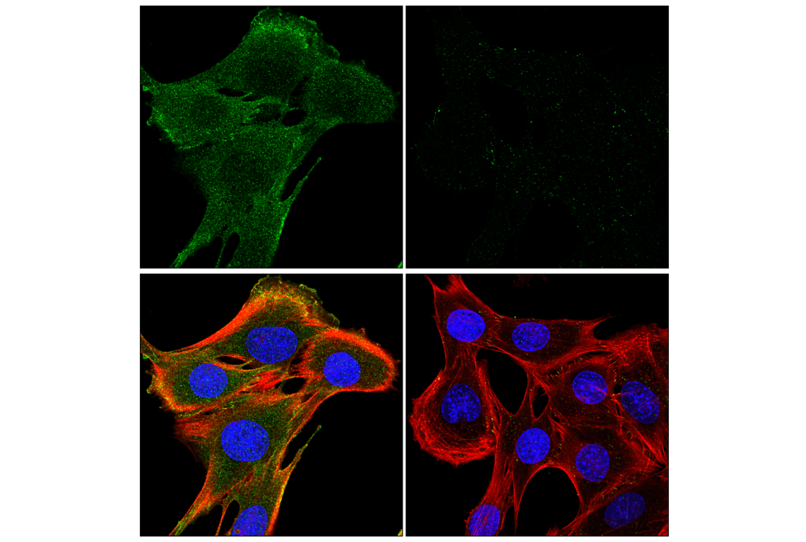 Immunofluorescence Image 1: Phospho-Akt (Ser473) (E4U3U) Mouse mAb