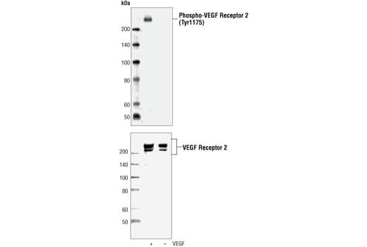 undefined Image 17: Angiogenesis Antibody Sampler Kit