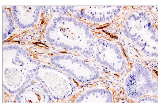 Immunohistochemistry Image 5: CD141/Thrombomodulin (E7Y9P) XP<sup>®</sup> Rabbit mAb (BSA and Azide Free)