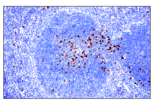 Immunohistochemistry Image 1: IL-2Rα/CD25 (E4B2Z) XP<sup>®</sup> Rabbit mAb (BSA and Azide Free)