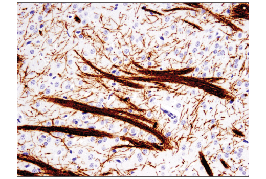 Immunohistochemistry Image 4: MOG (E5K6T) XP<sup>®</sup> Rabbit mAb