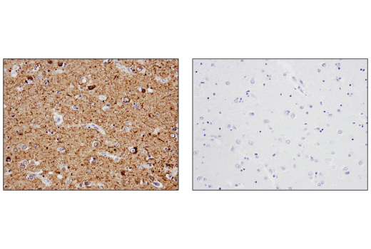 undefined Image 28: LRP1-mediated Endocytosis and Transmission of Tau Antibody Sampler Kit