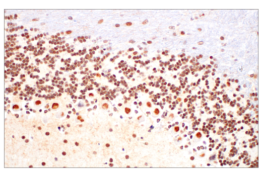 Immunohistochemistry Image 5: Ezh2 (D2C9) XP<sup>®</sup> Rabbit mAb (BSA and Azide Free)