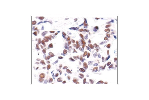 undefined Image 8: PhosphoPlus<sup>®</sup> CREB (Ser133) Antibody Duet