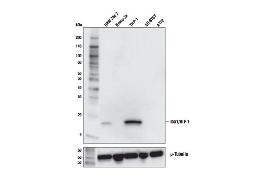 Mouse Reactive Alzheimer's Disease Model Microglia Phenotyping IF Antibody Sampler Kit: Image 1