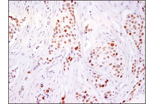 Immunohistochemistry Image 1: Ezh2 (D2C9) XP<sup>®</sup> Rabbit mAb (BSA and Azide Free)