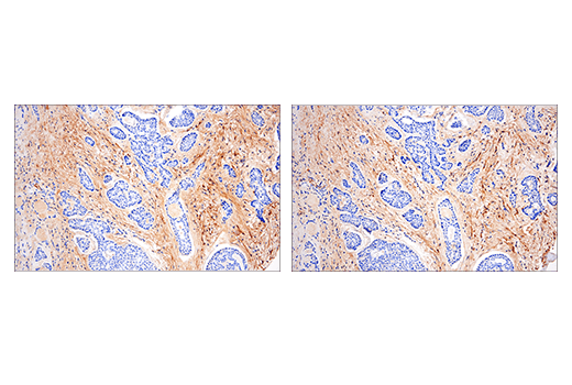 undefined Image 44: Extracellular Matrix Dynamics Antibody Sampler Kit