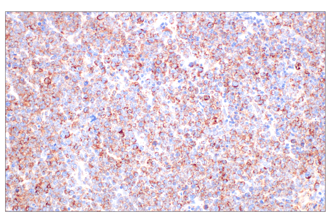 undefined Image 51: Cell Fractionation Antibody Sampler Kit