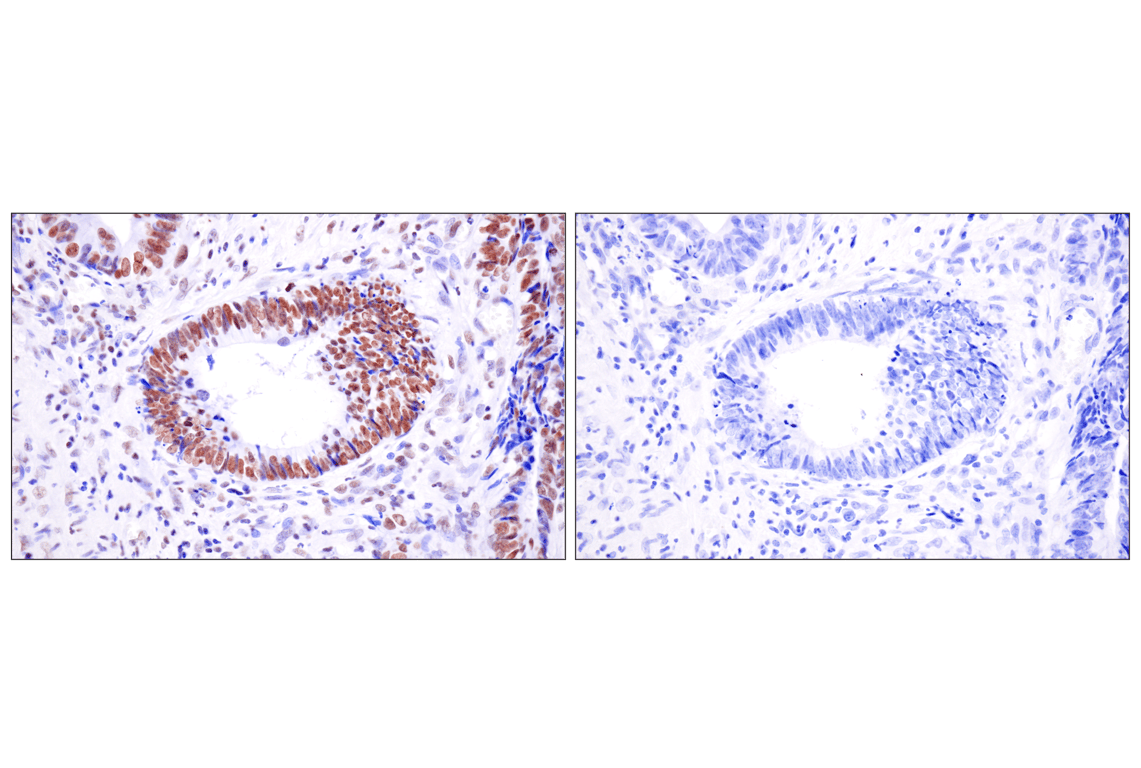 Immunohistochemistry Image 13: Acetyl-Histone H4 (Lys16) (E2B8W) Rabbit mAb