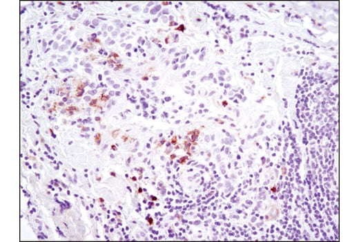 Immunohistochemistry Image 3: Axl (C89E7) Rabbit mAb (BSA and Azide Free)