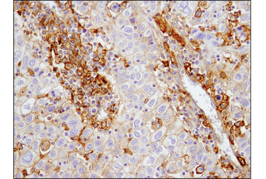 Immunohistochemistry Image 1: CD40 (D8W3N) Rabbit mAb