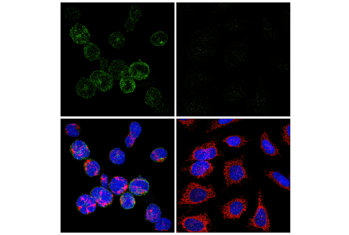 Immunofluorescence Image 1: PD-1 (Intracellular Domain) (D4W2J) XP<sup>®</sup> Rabbit mAb