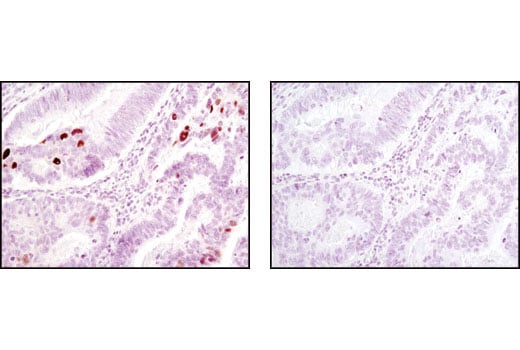 undefined Image 4: PhosphoPlus<sup>®</sup> Chk2 (Thr68) Antibody Duet