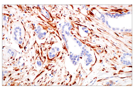 Immunohistochemistry Image 7: p16 INK4A (BC42) Mouse mAb