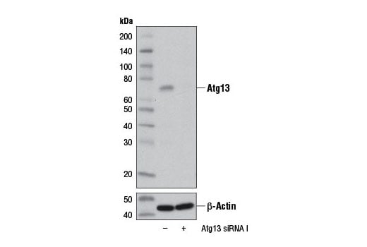 Western Blotting Image 3: Atg13 (D4P1K) Rabbit mAb