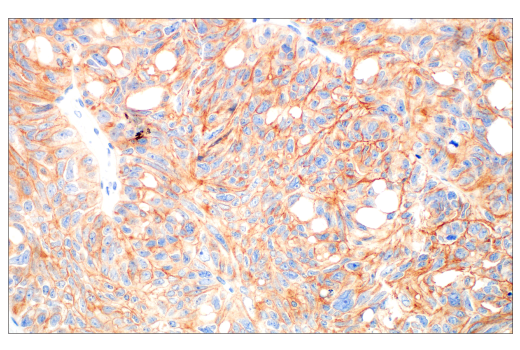 Immunohistochemistry Image 2: HER3/ErbB3 (D22C5) XP<sup>®</sup> Rabbit mAb